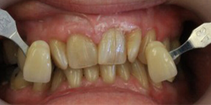 Before - dental397