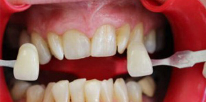 After - dental397