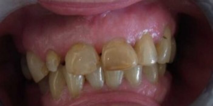 Before - dental397