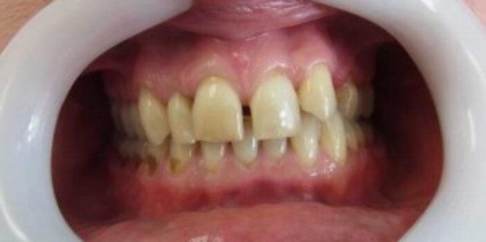 Before - dental397