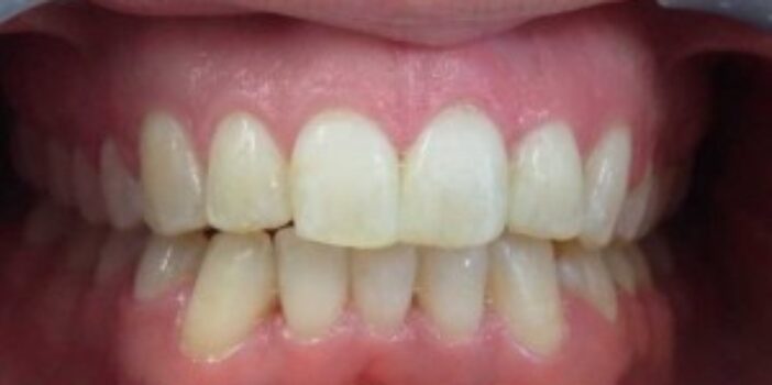 After - dental397