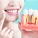 Treatment - Dental397