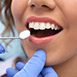 Treatment - Dental397