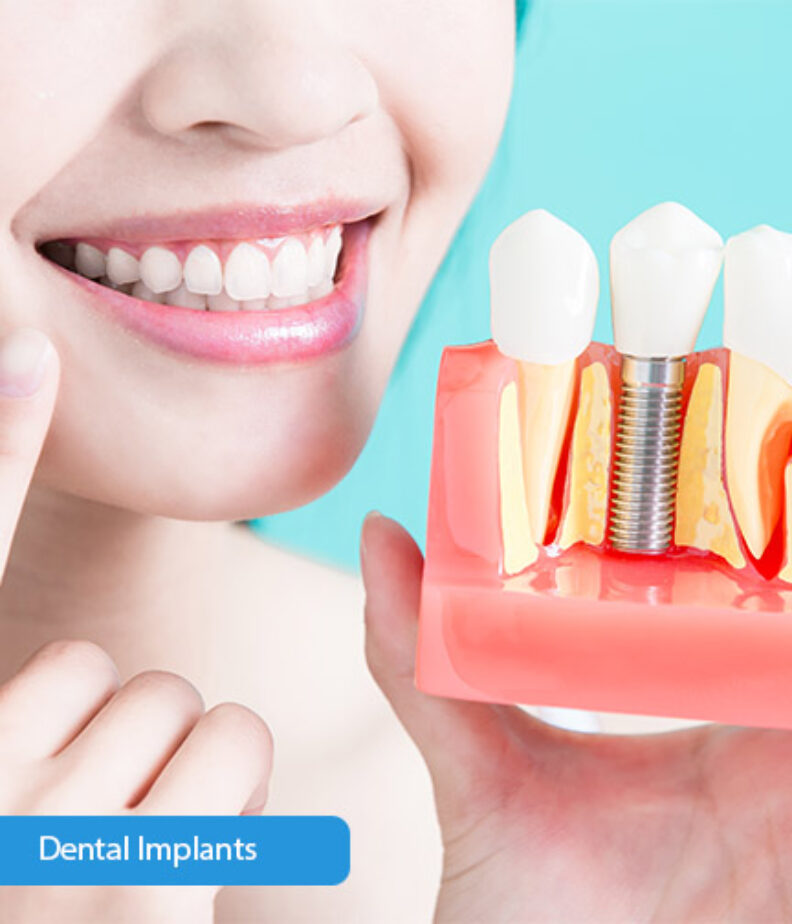 Treatment - dental397